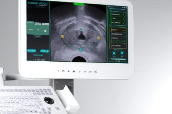 A monitor displays a monochrome image as well as other data on a screen. A keyboard is below the monitor, slightly offset to the left.