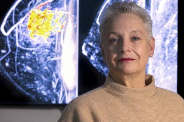 Doris Shank stands in front of x-ray images of a breast.