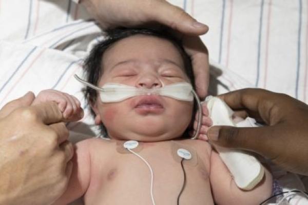Newborn Aiden Shimp, who has a full head of hair, lies on striped sheets with his eyes closed and his parents’ hands cradling his head and holding each of his hands. He wears a canula in his nose and monitors on his chest.